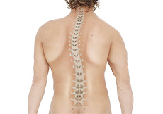 Scoliosis